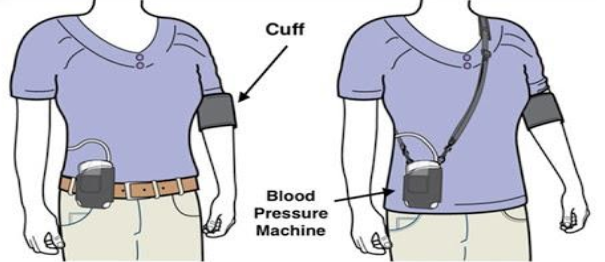 Do you wear a 24 hour blood pressure monitor in bed?